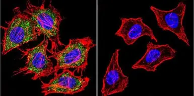Anti-AHR antibody [RPT9] used in  (). GTX22769