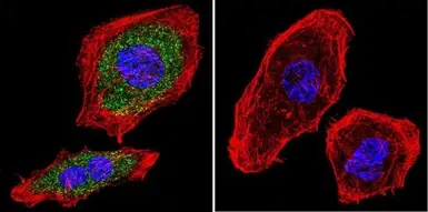 Anti-AHR antibody [RPT9] used in  (). GTX22769