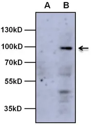 Anti-AHR antibody [RPT9] used in Western Blot (WB). GTX22769