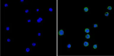Anti-GRK1 antibody [G8] used in Immunocytochemistry/ Immunofluorescence (ICC/IF). GTX22775