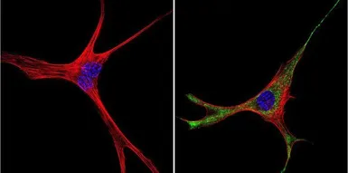 Anti-GRK1 antibody [G8] used in Immunocytochemistry/ Immunofluorescence (ICC/IF). GTX22775