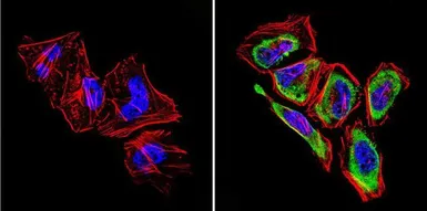 Anti-GRK1 antibody [D11] used in Immunocytochemistry/ Immunofluorescence (ICC/IF). GTX22776
