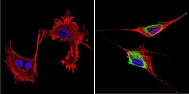 Anti-GRK1 antibody [D11] used in Immunocytochemistry/ Immunofluorescence (ICC/IF). GTX22776