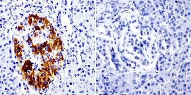 Anti-SRC3 antibody [AX15.3] used in IHC (Paraffin sections) (IHC-P). GTX22782