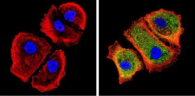 Anti-Galectin 3 antibody [A3A12] used in Immunocytochemistry/ Immunofluorescence (ICC/IF). GTX22785