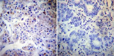 Anti-Calnexin antibody [AF18] used in IHC (Paraffin sections) (IHC-P). GTX22798