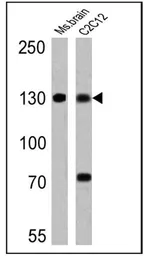 Anti-pan NOS antibody [NOS-3F7-B11 B5] used in Western Blot (WB). GTX22801