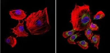 Anti-pan NOS antibody [NOS-3F7-B11 B5] used in Immunocytochemistry/ Immunofluorescence (ICC/IF). GTX22801