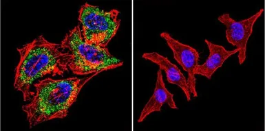 Anti-AChE antibody [HR2] used in Immunocytochemistry/ Immunofluorescence (ICC/IF). GTX22803