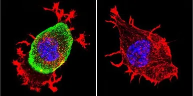 Anti-AChE antibody [HR2] used in Immunocytochemistry/ Immunofluorescence (ICC/IF). GTX22803