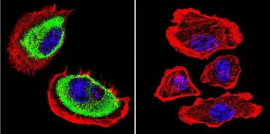 Anti-AChE antibody [HR2] used in Immunocytochemistry/ Immunofluorescence (ICC/IF). GTX22803