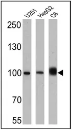 Anti-Importin beta 1 antibody [3E9] used in Western Blot (WB). GTX22811