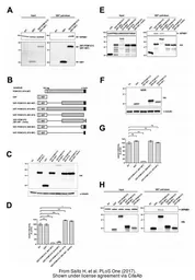 Anti-Importin beta 1 antibody [3E9] used in Western Blot (WB). GTX22811