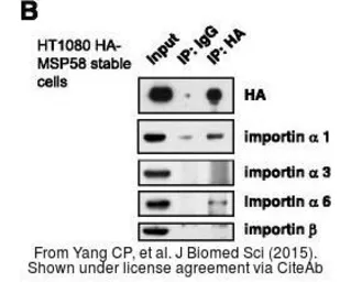Anti-Importin beta 1 antibody [3E9] used in Western Blot (WB). GTX22811