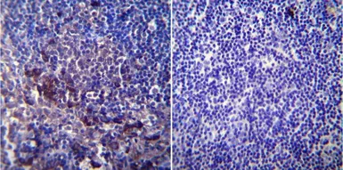 Anti-SERCA1 ATPase antibody [IIH11] used in IHC (Paraffin sections) (IHC-P). GTX22818