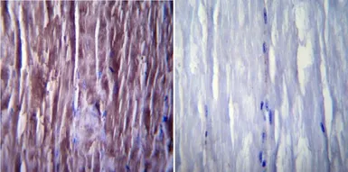 Anti-SERCA1 ATPase antibody [IIH11] used in IHC (Paraffin sections) (IHC-P). GTX22818