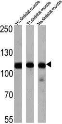 Anti-SERCA1 ATPase antibody [IIH11] used in Western Blot (WB). GTX22818