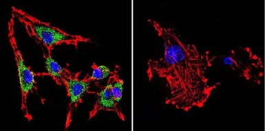 Anti-SERCA1 ATPase antibody [IIH11] used in Immunocytochemistry/ Immunofluorescence (ICC/IF). GTX22818