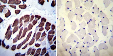 Anti-SERCA1 ATPase antibody [VE121G9] used in IHC (Paraffin sections) (IHC-P). GTX22819