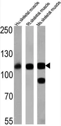Anti-SERCA1 ATPase antibody [VE121G9] used in Western Blot (WB). GTX22819