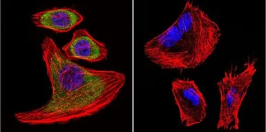 Anti-SERCA1 ATPase antibody [VE121G9] used in Immunocytochemistry/ Immunofluorescence (ICC/IF). GTX22819