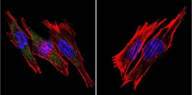 Anti-SERCA1 ATPase antibody [VE121G9] used in Immunocytochemistry/ Immunofluorescence (ICC/IF). GTX22819