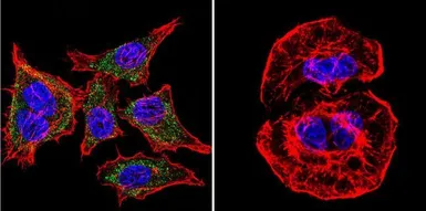 Anti-SERCA1 ATPase antibody [VE121G9] used in Immunocytochemistry/ Immunofluorescence (ICC/IF). GTX22819