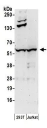 Anti-Chk1 antibody used in Western Blot (WB). GTX22845