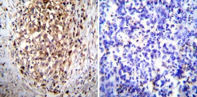 Anti-Hydrogen Potassium ATPase Beta antibody [2G11] used in IHC (Paraffin sections) (IHC-P). GTX22866