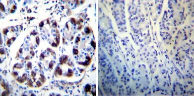 Anti-Hydrogen Potassium ATPase Beta antibody [2G11] used in IHC (Paraffin sections) (IHC-P). GTX22866
