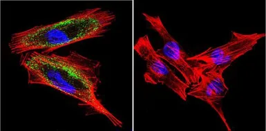 Anti-Hydrogen Potassium ATPase Beta antibody [2G11] used in Immunocytochemistry/ Immunofluorescence (ICC/IF). GTX22866