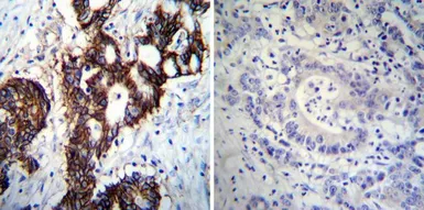 Anti-Sodium/Potassium ATPase alpha 1 antibody [M7-PB-E9] used in IHC (Paraffin sections) (IHC-P). GTX22871