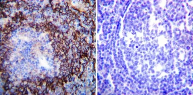Anti-Sodium/Potassium ATPase alpha 1 antibody [M7-PB-E9] used in IHC (Paraffin sections) (IHC-P). GTX22871