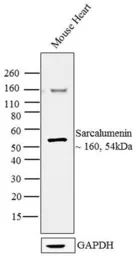 Anti-Sarcalumenin antibody [XIIC4] used in Western Blot (WB). GTX22874