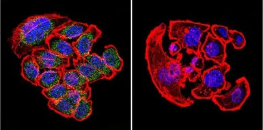 Anti-KDEL antibody used in Immunocytochemistry/ Immunofluorescence (ICC/IF). GTX22898