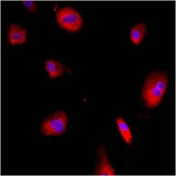 Anti-Grp78 antibody used in Immunocytochemistry/ Immunofluorescence (ICC/IF). GTX22902