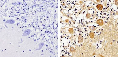 Anti-pan Arrestin antibody used in IHC (Paraffin sections) (IHC-P). GTX22914