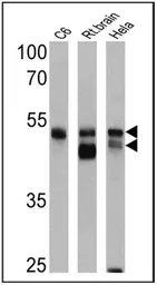 Anti-pan Arrestin antibody used in Western Blot (WB). GTX22914