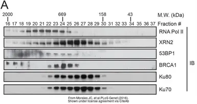 Anti-Ku70 antibody [N3H10] used in Western Blot (WB). GTX23114