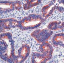 Anti-Paxillin antibody [5H11] used in IHC (Paraffin sections) (IHC-P). GTX23127