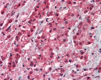 Anti-TRPM8 antibody used in IHC (Paraffin sections) (IHC-P). GTX23243