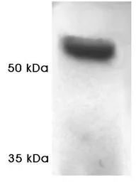 Anti-Proteasome 19S Subunit S4 antibody used in Western Blot (WB). GTX23317