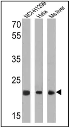 Anti-PSMB5 antibody used in Western Blot (WB). GTX23330