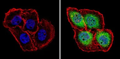 Anti-PSMB5 antibody used in Immunocytochemistry/ Immunofluorescence (ICC/IF). GTX23330