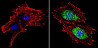 Anti-PSMB5 antibody used in Immunocytochemistry/ Immunofluorescence (ICC/IF). GTX23330