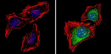 Anti-PSMB5 antibody used in Immunocytochemistry/ Immunofluorescence (ICC/IF). GTX23330