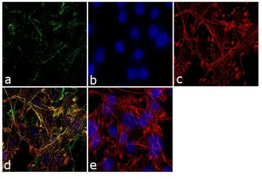 Anti-RAB3D antibody used in Immunocytochemistry/ Immunofluorescence (ICC/IF). GTX23337
