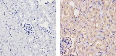 Anti-Ubiquilin 1 antibody used in IHC (Paraffin sections) (IHC-P). GTX23341
