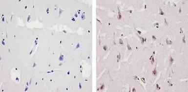 Anti-Ubiquilin 1 antibody used in IHC (Paraffin sections) (IHC-P). GTX23341