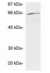 Anti-Ubiquilin 1 antibody used in Western Blot (WB). GTX23341
